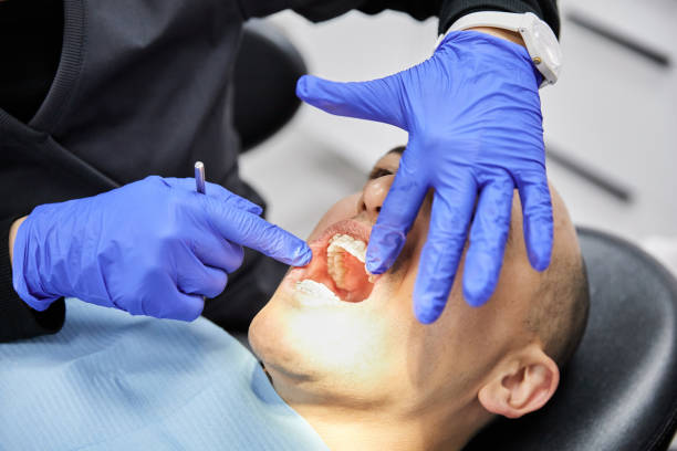 Best Broken or Cracked Tooth Emergency Dentist in Hudson, WI